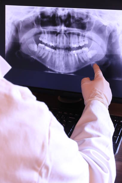 Best Emergency Treatment for Dental Infections or Abscesses in Lasalle, IL